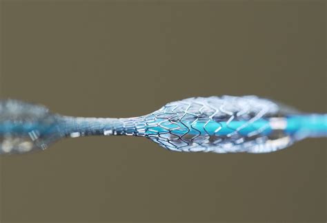  Nitinol: Un Super Materiale per Impianti Medicali Innovativi!